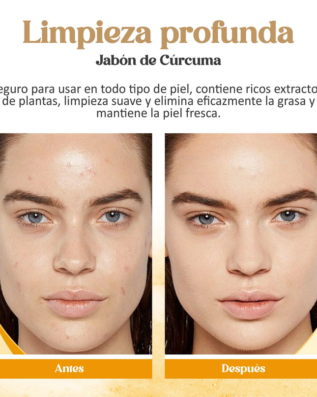 Jabon Curcuma Ideal para limpiar, nutrir y mejorar la apariencia de la piel